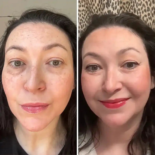 CALI BALM FOR UNDER-EYE RENEWAL