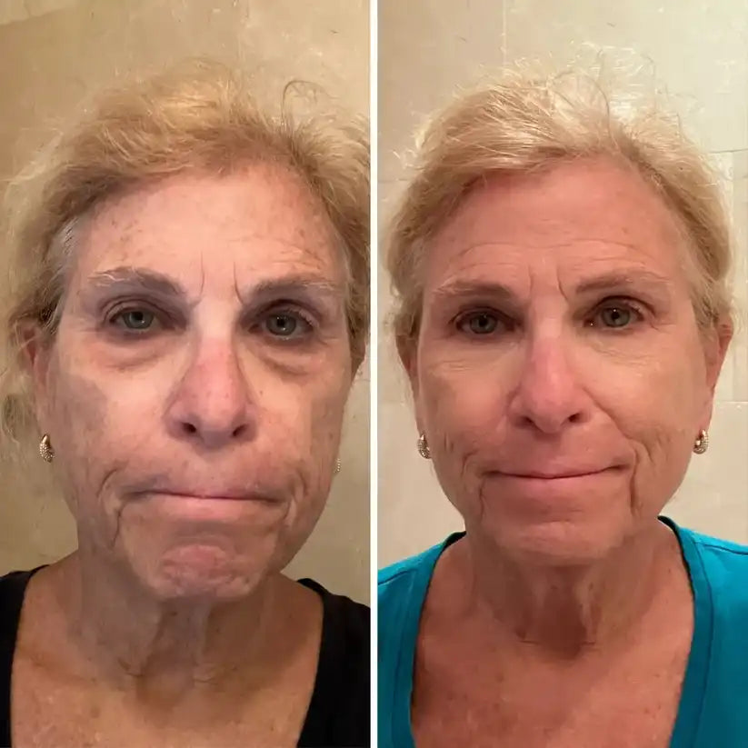 THE SKINCARE INDUSTRY IS LYING TO YOU