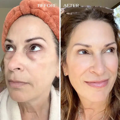 CALI BALM FOR UNDER-EYE RENEWAL