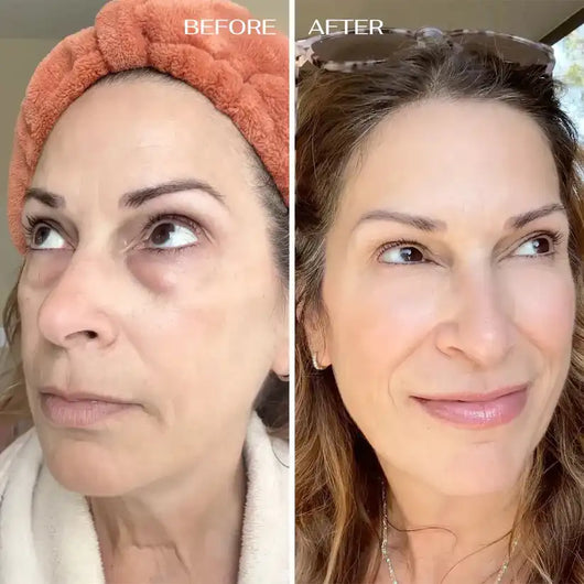 CALI BALM FOR UNDER-EYE RENEWAL